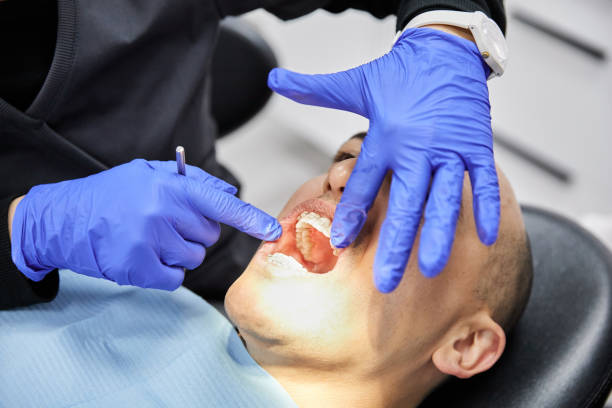 Best Knocked-Out Tooth (Avulsed Tooth) Treatment in Gentry, AR